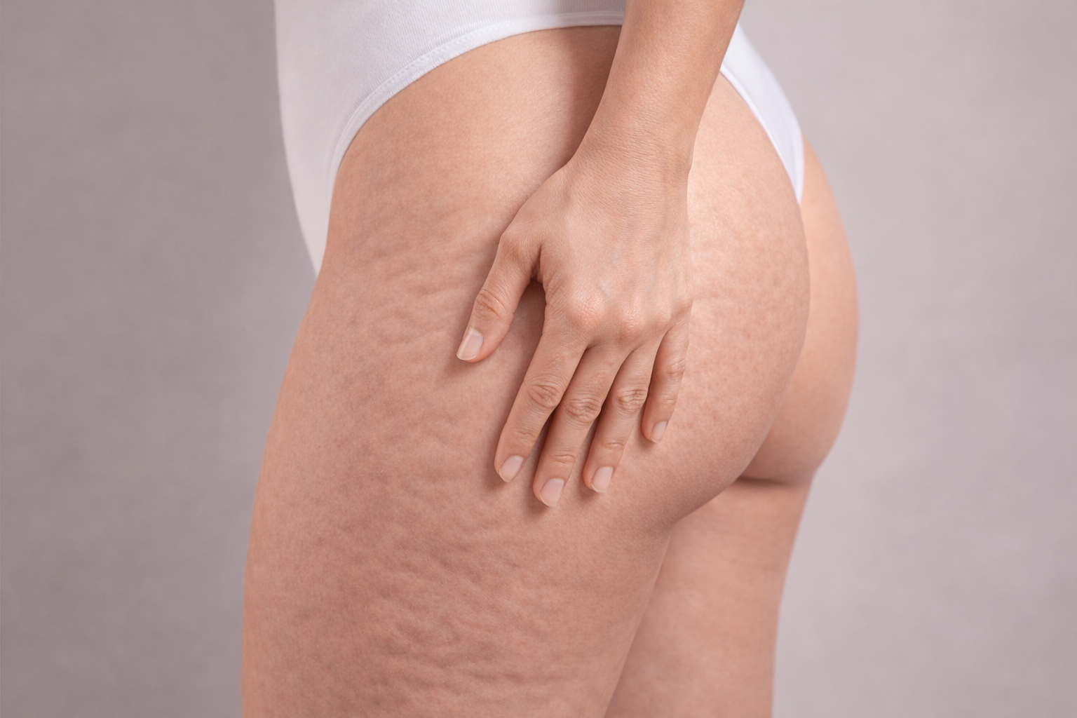 cellulite cosce pelle a buccia d'arancia dettaglio pelle